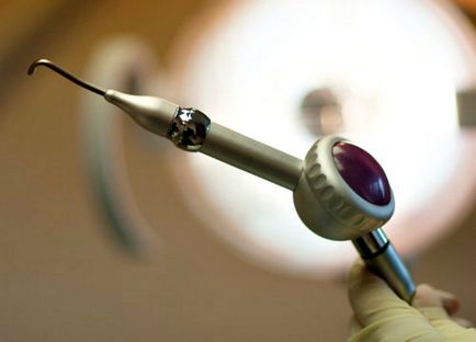 Какво да изберете почистване от стоматолог или избелване