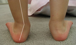 Детски ортопедични и анатомични обувки