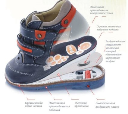 Детски ортопедични обувки правило селекция