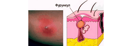 Ожулвания снимки, причини и лечение