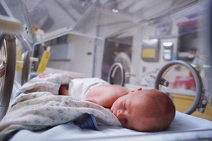 Хипоксия при новороденото - какво е това и как да се справят с него