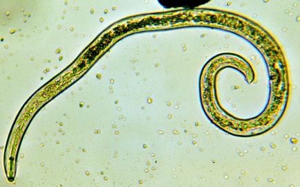 Worms в предната част на снимка човек, симптоми, лечение