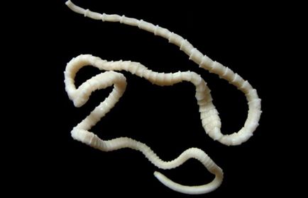 Worms в предната част на снимка човек, симптоми, лечение
