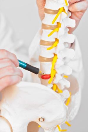 Херния на лумбалния отдел на гръбначния стълб лечение, симптоми