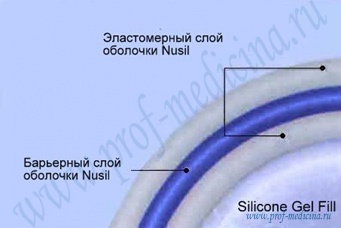 Гръдните импланти eurosilicone - размери директория, прегледи