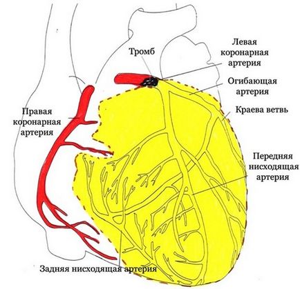 Миокардните симптоми и лечение на миокарда