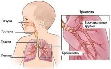 Колко бързо лекува бронхит при дете