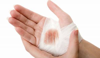 Как и какво да се спре кървенето с нарязани (дълбок, силен, бръснач)
