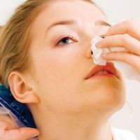 Как да спрем кръвотечение от носа