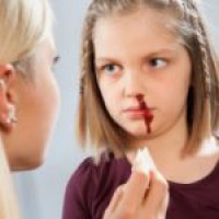 Как да се спре кървенето от носа на възрастен у дома какво да правя