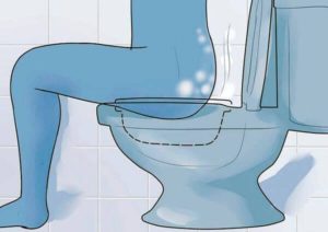 Как да направите банята за хемороиди у дома