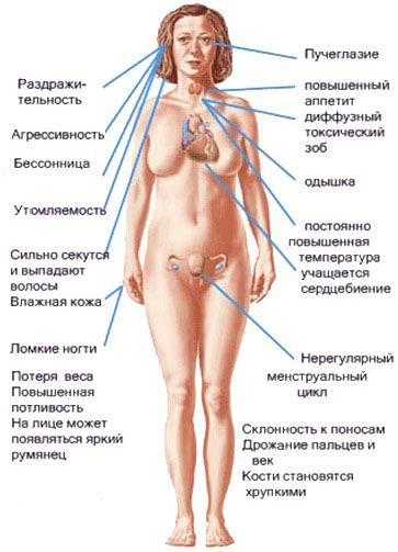 Както самопроверка на щитовидната жлеза е като у дома си