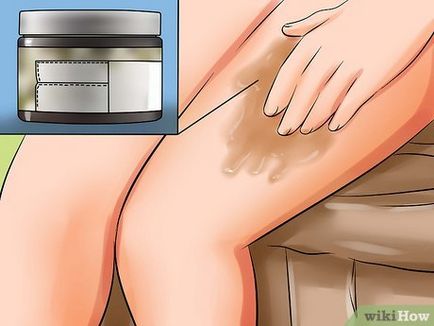 Как да се скрие стрии по краката