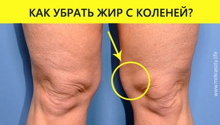 Как да премахнете мазнината върху коленете