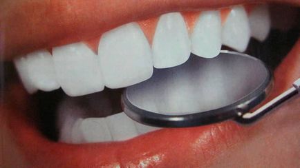 Как да се лекува зъб у дома