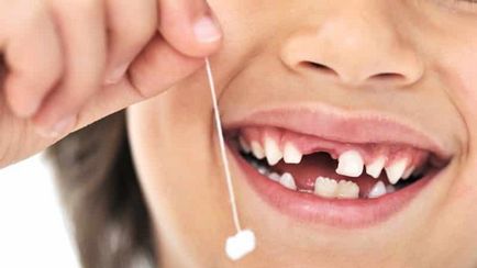 Как да извадя зъбите у дома безопасно и bіstro