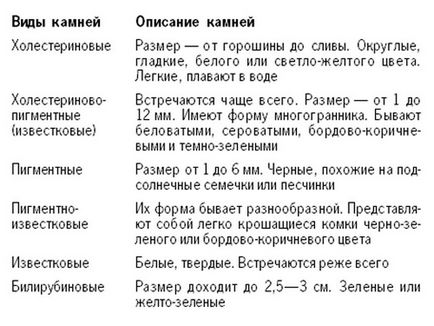 Камъни в жлъчката в симптомите на черния дроб, как да се отървете и лечение