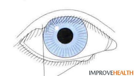 Киста очи - причини, симптоми, лечение