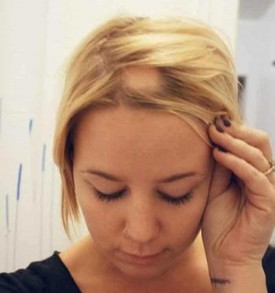 Криотерапия коса като течен азот засяга как процедурата и лечението