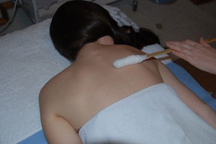 Криотерапия - лечение на течен азот (студени) типове, противопоказания, ревюта, снимки и цени