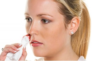 Кървене от носа как да се спре на видеото - жена и ден