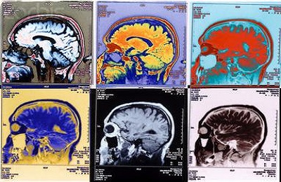 Rm съдове (CT) на мозъка и шията, сърцето и долните крайници, което е