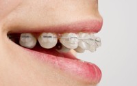 Лечение и протези на цена зъби