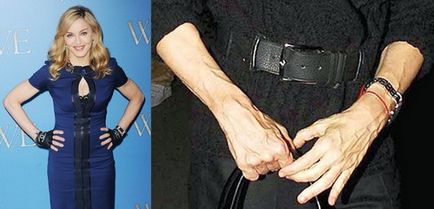 Мадона пластична хирургия снимки преди и след
