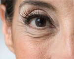 Бръчки около очите - причини, симптоми, диагностика и лечение