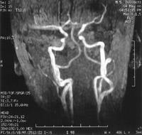 MRI експерт, г-н ангиография в изследването на мозъчните артерии