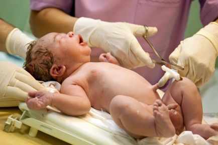 Лечение на пъпната рана в едно новородено бебе у дома (пъпа)