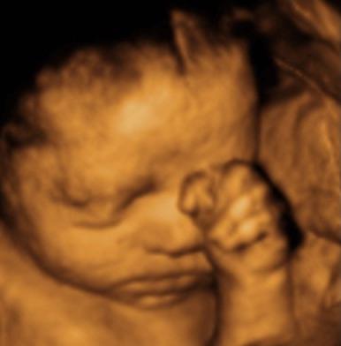 Определяне на пола на бебето при ултразвуково изследване, най-точно