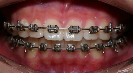 Преглед на Smile Dental (Краснодар)