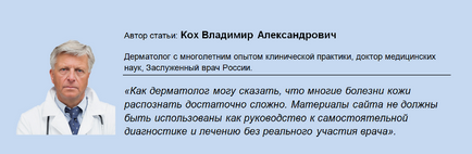 Защо мишниците сърбят причини и лечение