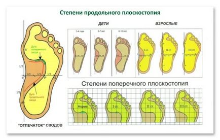 Защо не вземете дюстабан в армията