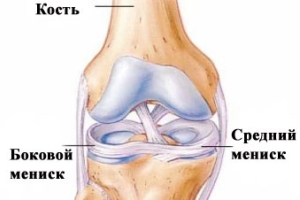 Повреда на менискуса на коляното - лечение в домашни условия, упражнения