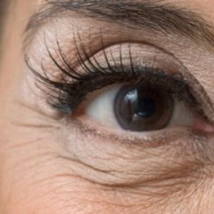 Причините за по бръчици около очите и ефективни начини за справяне с тях, bezmorshchin