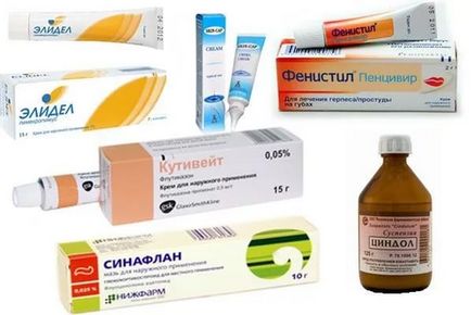 Средствата от алергии преглед и експлоатация на най-ефективните лекарства и средства за защита народни