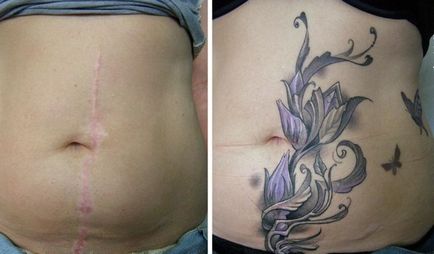 Татуировка по корем за жените след раждане, за да се скрие стрии
