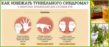 Карпалния тунел синдром симптоми, лечение у дома