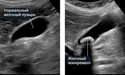 Коремна ехография е включена, което органи изглеждат