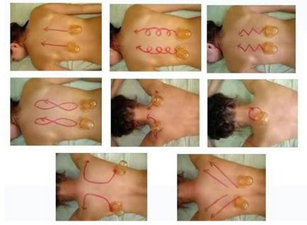 Вакуум Антицелулитен масаж - Банки в дома usliviyah, ревюта, видео