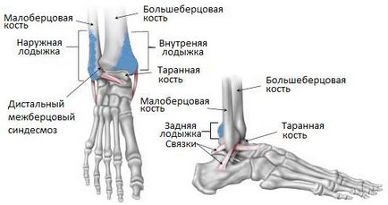 Изкълчи глезена лечение, симптоми и първа помощ