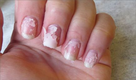 Възстановяване Nails след изграждането на рецепти и съвети