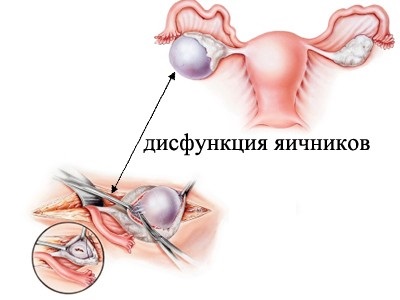 Стойността на яйчниците в женското тяло