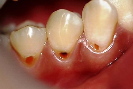 човешки зъби