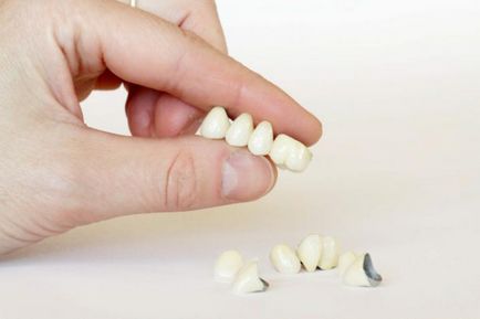 Зъби керамичен описание, характеристики, производство и ревюта