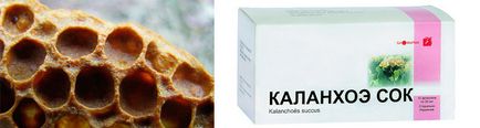 Как и какво лечение perleches Как и какво лечение perleches
