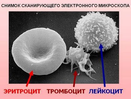 От това, което много бели кръвни клетки в кръвта