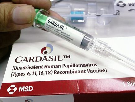 Как да получите HPV